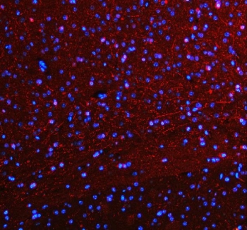Immunofluorescent staining of FFPE mouse brain tissue with SERT antibody (red) and DAPI nuclear stain (blue). HIER: steam section in pH8 EDTA buffer for 20 min.