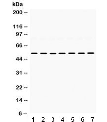 Western blot testing of 1) rat heart, 2) rat brain, 3) rat liver, 4) mouse liver, 5) mouse lung, 6) human 22RV1, and 7) human SMMC lysate with ADRA1A antibody. Expected/observed molecular weight ~52 kDa.