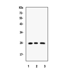 Western blot testing of 1) rat brain, 2) human Raji and 3) human SMMC lysate with RAB14 antibody. Expected/observed molecular weight ~24 kDa.