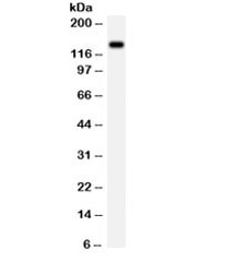 Western blot testing of rat brain lysate with NMDAR2C antibody.  Expected/observed molecular weight ~134 kDa.