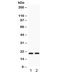 Western blot testing of 1) rat heart and 2) rat muscle lysate with HSPB2 antibody. Predicted/observed molecular weight ~20 kDa.