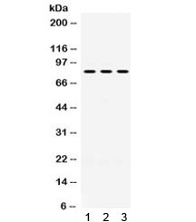 Western blot testing of 1) rat brain, 2) mouse brain, 3) U87 lysate with PAK5 antibody. Expected/observed molecular weight ~81 kDa.