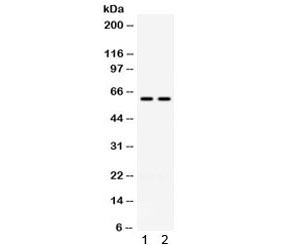 Western blot testing of 1) rat kidney and 2) human HeLa lysate with CCT3 antibody. Expected molecular weight ~61 kDa.