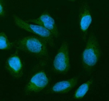 Immunofluorescent staining of FFPE human U-2 OS cells with Cofilin 2 antibody (green) and DAPI nuclear stain (blue). HIER: steam section in pH6 citrate buffer for 20 min.
