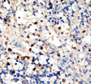 IHC staining of FFPE human spleen tissue with Platelet factor 4 antibody, HRP-secondary and DAB substrate. HIER: boil tissue sections in pH8 EDTA for 20 min and allow to cool before testing.