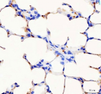 IHC staining of FFPE mouse lung tissue with Pf4 antibody. HIER: boil tissue sections in pH8 EDTA for 20 min and allow to cool before testing.
