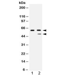 Western blot testing of 1) human placenta and 2) HepG2 lysate with Carboxypeptidase B2 antibody at 0.5ug/ml. Predicted molecular weight: ~48 kDa but routinely observed at 50-60 kDa.