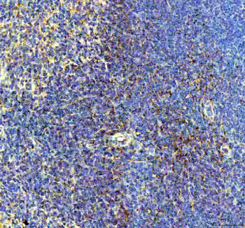 IHC staining of FFPE mouse spleen tissue with BCA1 antibody, HRP-secondary and DAB substrate. HIER: boil tissue sections in pH8 EDTA for 20 min and allow to cool before testing.