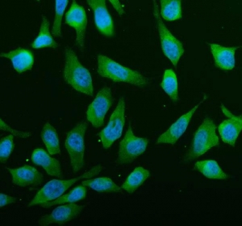 Immunofluorescent staining of FFPE human HeLa cells with ABCE1 antibody (green) and DAPI nuclear stain (blue). HIER: steam section in pH6 citrate buffer for 20 min.