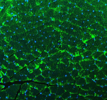 Immunofluorescent staining of FFPE mouse skeletal muscle tissue with ACTN3 antibody (green) and DAPI nuclear stain (blue). HIER: steam section in pH8 EDTA buffer for 20 min.