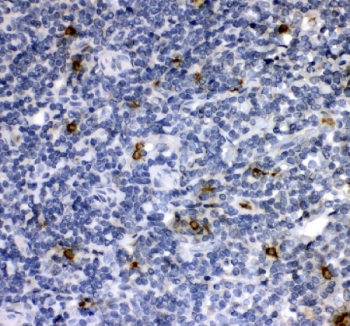 IHC staining of FFPE human tonsil tissue with Cathepsin G antibody. HIER: boil tissue sections in pH8 EDTA for 20 min and allow to cool before testing.