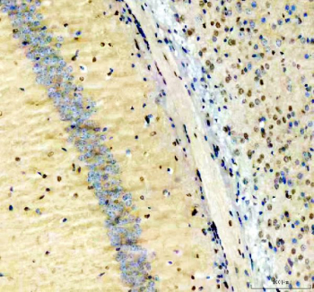 IHC staining of FFPE mouse brain tissue with NFIA antibody, HRP-secondary and DAB substrate. HIER: boil tissue sections in pH8 EDTA for 20 min and allow to cool before testing.