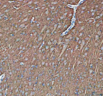 IHC staining of FFPE pig brain tissue with Synapsin II antibody, HRP-secondary and DAB substrate. HIER: boil tissue sections in pH8 EDTA for 20 min and allow to cool before testing.