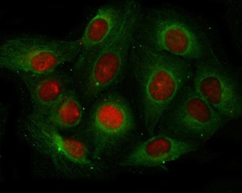 Immunofluorescent staining of FFPE human U-2 OS cells with Angiogenin antibody (green) and DAPI nuclear stain (blue). HIER: steam section in pH6 citrate buffer for 20 min.