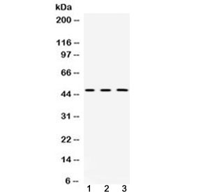 Western blot testing of 1) rat brain, 2) mouse brain and 3) human HeLa lysate with CNPase antibody at 0.5ug/ml. Predicted molecular weight ~47 kDa.