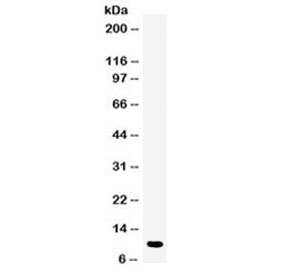 Western blot testing of human placenta lysate with DBI antibody at 0.5ug/ml. Predicted molecular weight ~10 kDa.