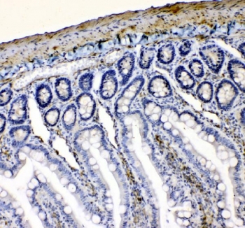IHC staining of FFPE rat intestine tissue with VASP antibody. HIER: boil tissue sections in pH8 EDTA for 20 min and allow to cool before testing.