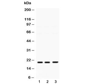 Western blot testing of 1) rat brain, 2) mouse brain and 3) human A549 lysate with HRAS antibody at 0.5ug/ml. Predicted molecular weight ~21 kDa.