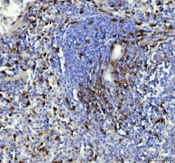 IHC testing of FFPE mouse spleen tissue with CD90 antibody. Required HIER: steam section in pH8 EDTA for 20 min and allow to cool prior to testing.