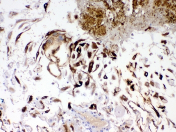 IHC testing of FFPE human placenta tissue with IGFBP1 antibody. Required HIER: steam section in pH8 EDTA buffer for 20 min and allow to cool prior to testing.
