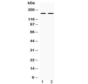Western blot testing of 1) rat brain and 2) mouse brain lysate with NOS1 antibody at 0.5ug/ml. Predicted molecular weight ~160 kDa.