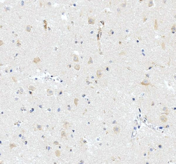 IHC staining of FFPE human brain tissue with iNOS antibody, HRP-secondary and DAB substrate. HIER: boil tissue sections in pH8 EDTA for 20 min and allow to cool before testing.