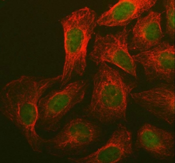 Immunofluorescent staining of FFPE human U-2 OS cells with BRCA1 antibody (green) and Beta Tubulin mAb (red). HIER: steam section in pH6 citrate buffer for 20 min.