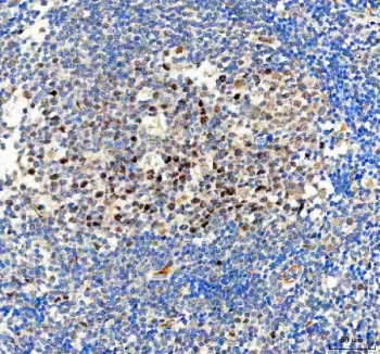 IHC staining of FFPE human tonsil tissue with BAG1 antibody. HIER: boil tissue sections in pH8 EDTA for 20 min and allow to cool before testing.