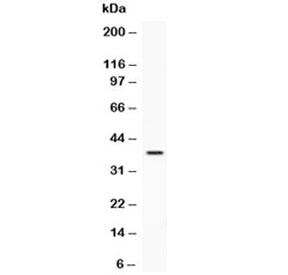 Western blot testing of recombinant human protein with IGFBP3 antibody at 0.5ug/ml. Expected molecular weight: ~31/40-44 kDa (unmodified/glycosylated).
