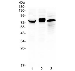 Western blot testing of 1) mouse thymus, 2) human HeLa and 3) human placenta lysate with ADAM17 antibody at 0.5ug/ml. Expected molecular weight: 80-130 kDa depending on level of glycosylation.