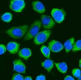 Immunofluorescent staining of FFPE human SiHa cells with DDX3 antibody (green) and DAPI nuclear stain (blue). HIER: steam section in pH6 citrate buffer for 20 min.