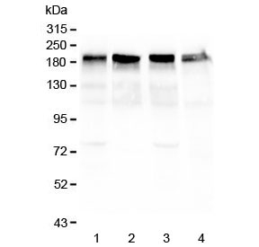 Western blot testing of 1) mouse lung, 2) rat heart, 3) rat lung and 4) human HeLa lysate with Laminin gamma antibody at 0.5ug/ml. Expected molecular weight: 172-200 kDa (G1 & G3), 130-140 kDa (G2).