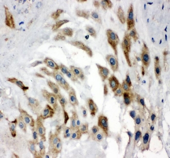IHC staining of FFPE human placental tissue with Noggin antibody. HIER: boil tissue sections in pH8 EDTA for 20 min and allow to cool before testing.