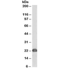 Western blot testing of human Jurkat lysate with biotinylated DJ-1 antibody at 0.2ug/ml. Predicted molecular weight ~20 kDa. An NAP blocker was used in place of non-fat milk as blocking solution and diluent. (1)