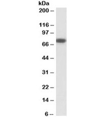 Western blot testing of human heart lysate with NGFR antibody at 0.3ug/ml. Predicted molecular weight ~45/75kDa (unmodified/glycosylated).
