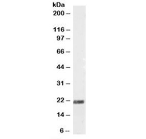 Western blot testing of mouse fetal brain lysate with SCG10 antibody at 0.5ug/ml. Predicted molecular weight: ~21 kDa.