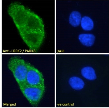 IF/ICC staining of fixed and permeabilized human A431 cells with LRRK2 antibody (green) at 10ug/ml and DAPI nuclear stain (blue).