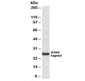 Western blot testing of human skin lysate with PMEL17 antibody at 1ug/ml. Predicted molecular weight: ~70/100/26 kDa (unmodified/glycosylated/M-beta fragment).