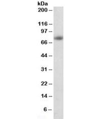 Western blot testing of human cerebral cortex lysate with APP antibody at 1ug/ml. Predicted molecular weight 79~120kDa depending on glycosylation level.