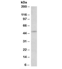 Western blot testing of NIH3T3 lysate with IL7R antibody at 2ug/ml. Predicted molecular weight: ~51/60-90kDa (unmodified/glycosylated).