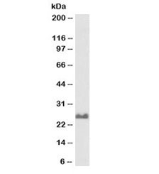 Western blot testing of rat brain lysate with biotinylated SNAP25 antibody at 0.1ug/ml. Expected molecular weight: ~25kDa.
