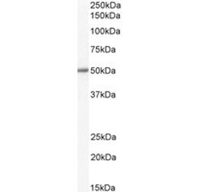 Western blot testing of human liver lysate with ALDH1B1 antibody. Predicted molecular weight: ~57 kDa.