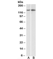 Western blot testing of HeLa [A] and HepG2 [B] lysates with Integrin alpha 1 antibody at 0.5ug/ml. Predicted molecular weight: ~131/150+ kDa (unmodified/glycosylated).
