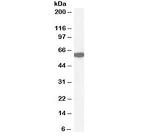 Western blot testing of human kidney lysate with Catalase antibody at 1ug/ml. Predicted molecular weight ~60 kDa.