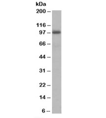 Western blot testing of human liver lysate with AKAP8 antibody at 1ug/ml. Predicted molecular weight: ~76kDa but routinely observed at ~95kDa.