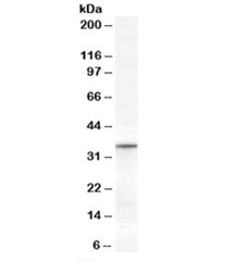 Western blot testing of human heart lysate with VDAC2 antibody at 0.3ug/ml. Predicted molecular weight: ~32kDa.