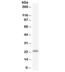 Western blot testing of human liver lysate with RBP4 antibody at 0.3ug/ml. Predicted molecular weight: ~23kDa.