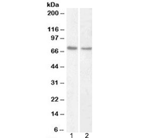Western blot testing of human 1) HeLa and 2) Jurkat nuclear fraction lysate with Lamin B1 antibody at 1ug/ml. Predicted molecular weight ~66 kDa.