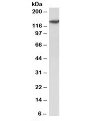 Western blot testing of human spleen lysate with SP140 antibody at 2ug/ml. Expected molecular weight: 100/140kDa.