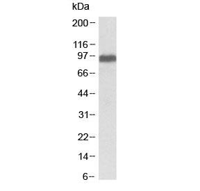 Western blot testing of human brain (frontal cortex) lysate with ITCH antibody at 0.1ug/ml. Predicted molecular weight: ~99 kDa.